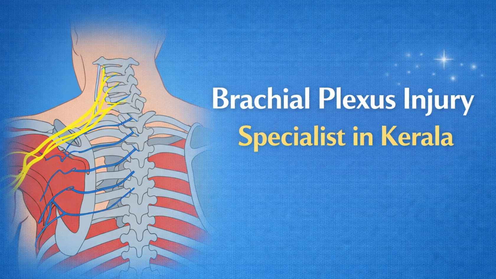 Brachial plexus nerve anatomy illustration showing shoulder nerve injury related to brachial plexus damage