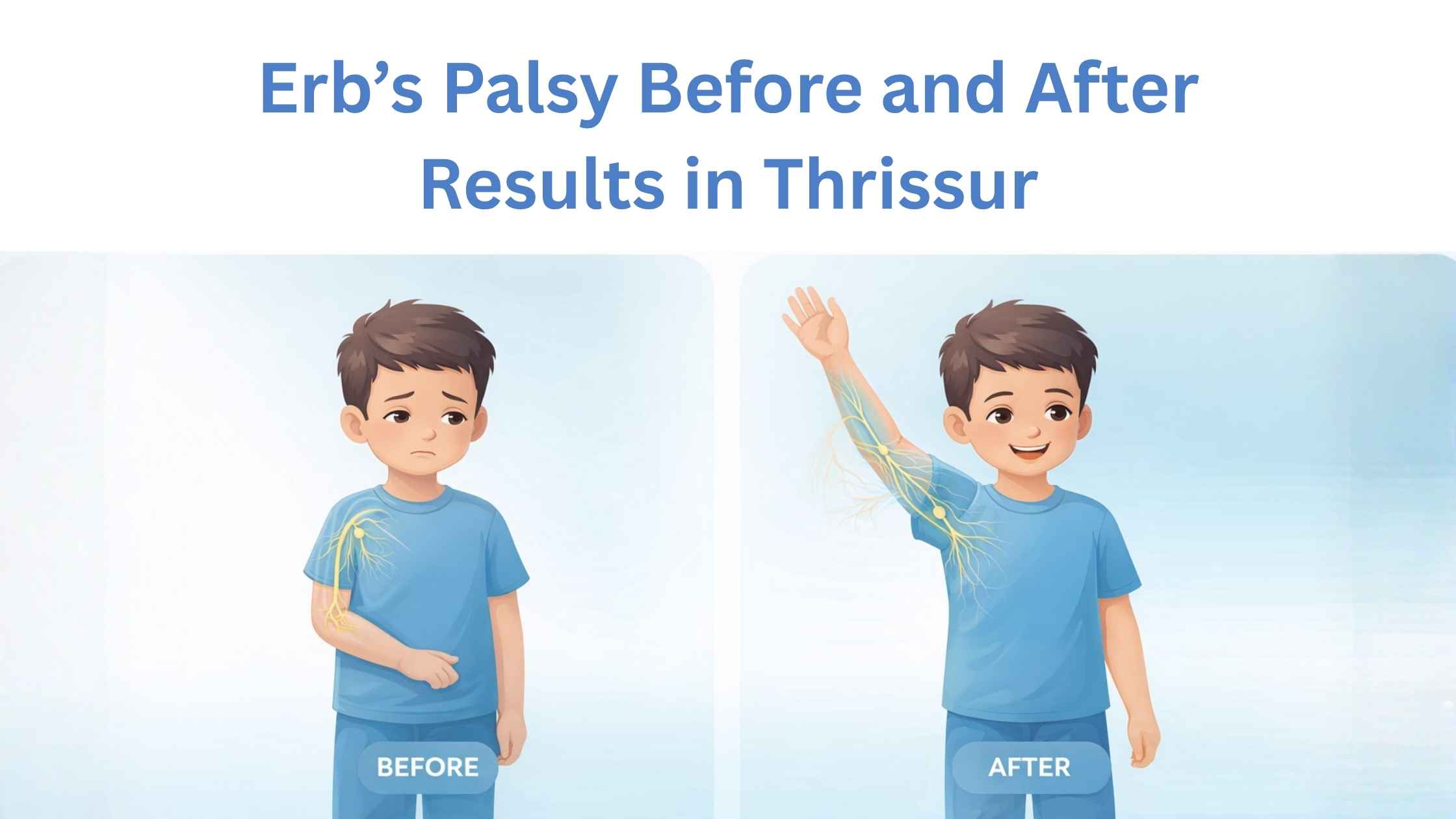 Erb’s Palsy Before and After Results in Thrissur showing improvement in arm movement and nerve recovery in a child