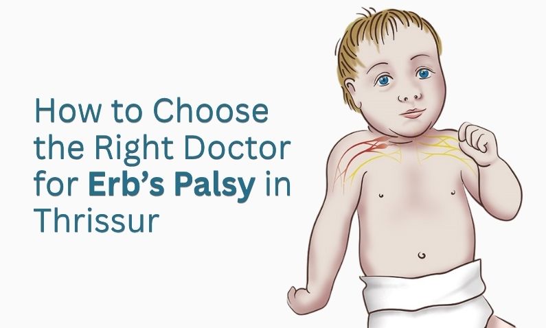 Illustration of an infant with highlighted shoulder nerves, representing Erb’s palsy condition.