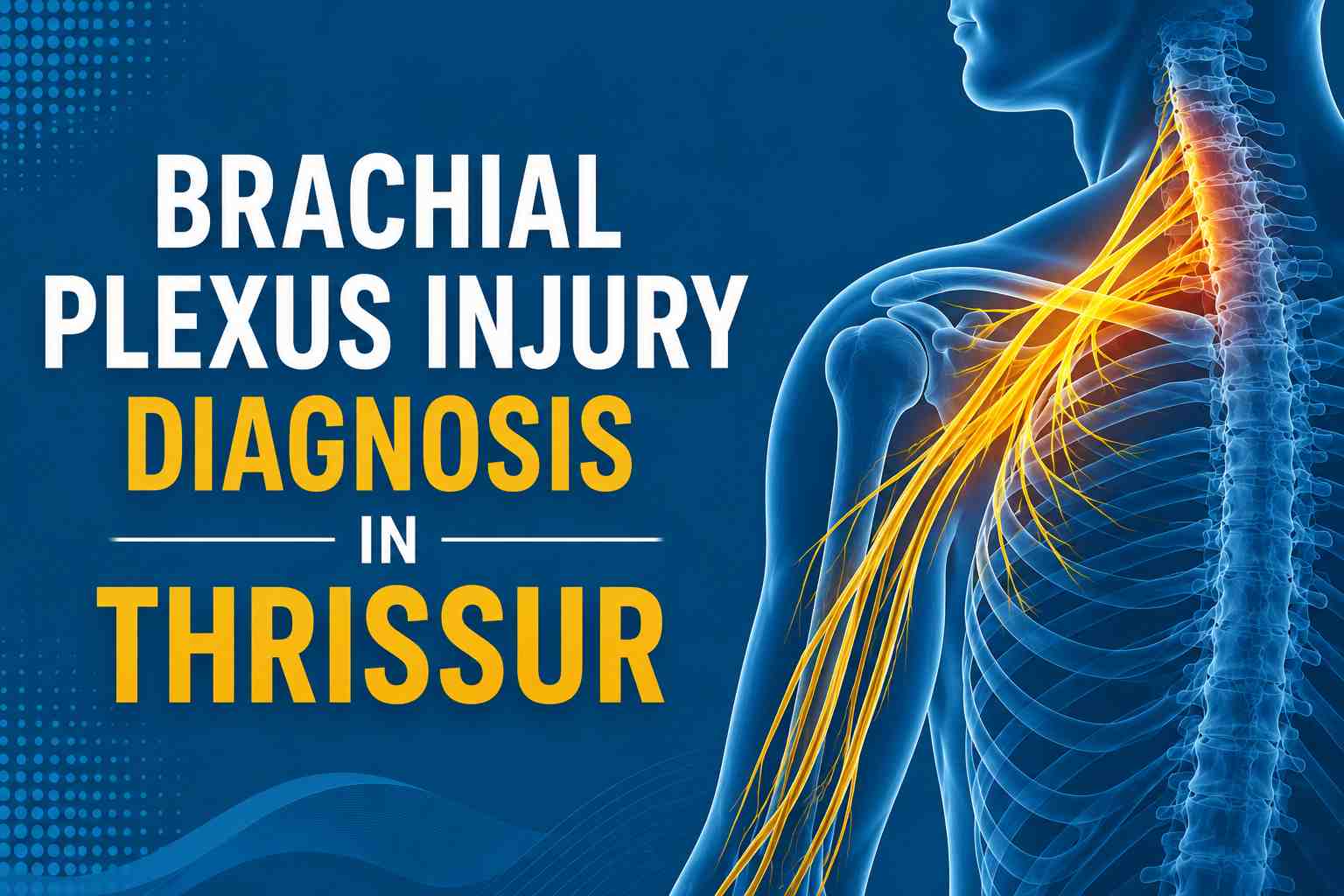 Medical illustration showing brachial plexus nerves highlighted for brachial plexus injury diagnosis in Thrissur.