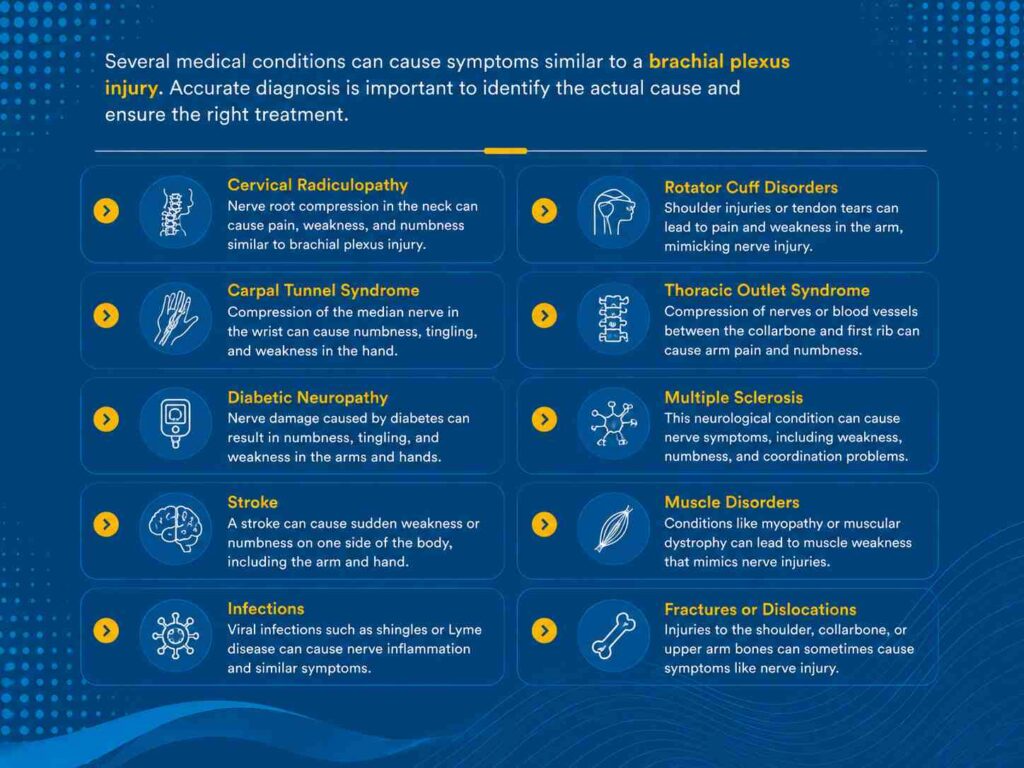 Infographic showing medical conditions that can mimic brachial plexus injury, including cervical radiculopathy, stroke, rotator cuff disorders, and thoracic outlet syndrome.
