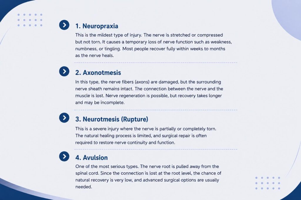 Main types of brachial plexus injuries including neuropraxia, axonotmesis, neurotmesis, and avulsion